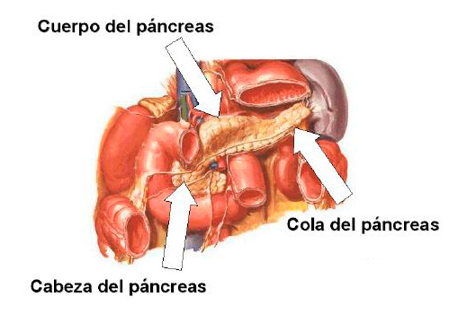 cancer pancreas